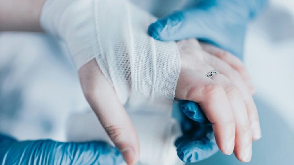 Compensation for burn injury claims