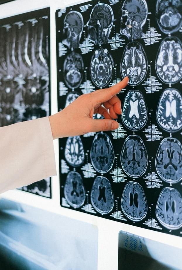 Head injury compensation claims